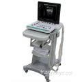 Type de Labtop Ultrasound portable